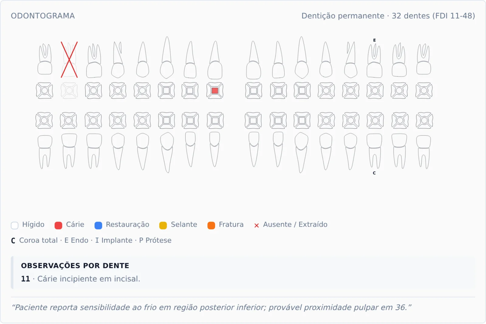 Odontograma do Clinikify em notação FDI: dentição permanente com extração e cárie marcadas, legenda de achados e observações por dente.